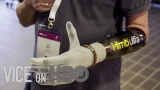 How Bionic Limbs Are Changing Lives