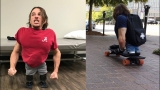 Legless man stands on feet for the first time | Boosting nub shoes