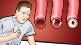 These Foods Clean Your Arteries & Can Prevent A Heart Attack