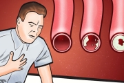 These Foods Clean Your Arteries & Can Prevent A Heart Attack